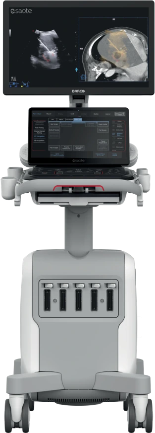 Esao MyLab™ E85 GTS